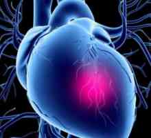 Спешна помощ за кардиогенен шок: алгоритъм на действие. Аварийна бригада за реанимация