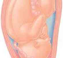 Ниското разположение на плацентата - причини и последици
