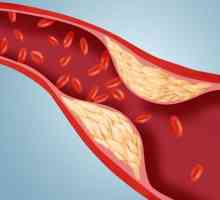 Нормата на холестерола в кръвта на мъжете. Индикатори на холестерола в кръвта