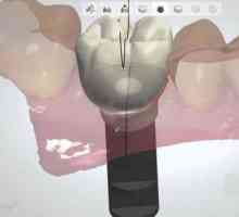 Най-новата технология в стоматологията: преглед на методите, функциите и обратната връзка
