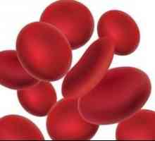 Какво може да се каже за повишаване на еритроцитите в кръвта