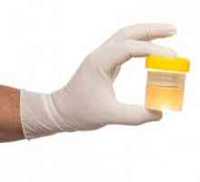 Общ съвет за правилното провеждане на тест за урината