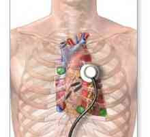 Изследване на сърцето. Ултразвук на сърцето: какво показва? Методи за изследване на сърцето