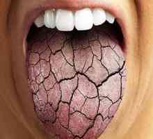 Основните причини за сухота в устата през нощта