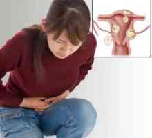 Основните симптоми на фибромиите