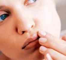 От това, което се появява херпесът на устните: причините, профилактиката, лечебните функции