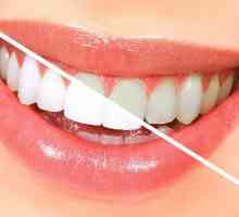 Избелващи ленти Crest 3D White: отзиви. Избелване на зъби: средства, цени, рецензии