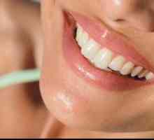 Избелване на зъби: експертни прегледи и препоръки