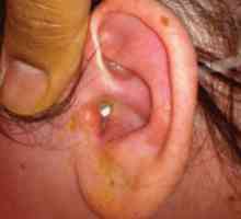 Отит на ухото: лечение, симптоми и причини
