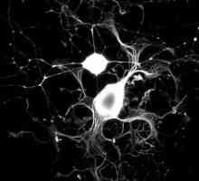Процеси на невроните: определение, структура, видове и функции