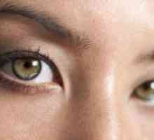 Изгаряне на очите от заваряването: какво да лекуваме у дома?