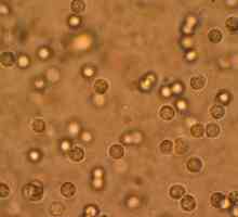 Патогенни бактерии в урината, какво означава това?