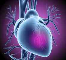 Първите симптоми на сърдечен удар при жените и мъжете