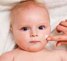 Пигментирани петна при деца: причини, лечение. Отстраняване на пигментираните петна