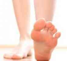 Наклонени стъпала: лечение с народни средства (йод, оцет, яйце)