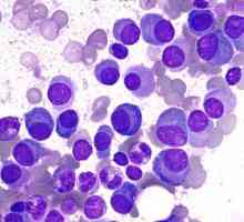 Плазмената клетка е важен компонент в левкоцитната среда