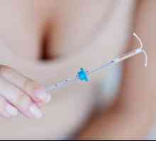 Плюсове и минуси на вътрематочното устройство от бременността