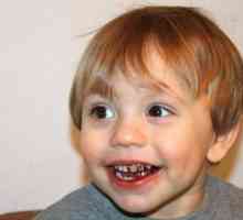 Защо са черни зъби на детето: възможни причини, как да се реши проблема