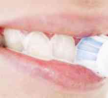 Защо кървене на венците, когато четка зъби: причини и лечение