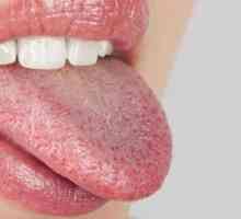 Защо плетиво в устата: причините, симптомите и характеристиките на лечението