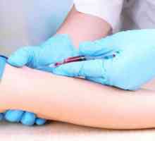 Подготовка за биохимичен кръвен тест: правила и съвети
