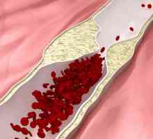 Указания за употреба "Индапамид" - артериална хипертония