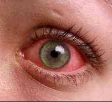 Зачервяване на очите при деца: причините и начините на лечение