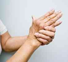 Полиартрит на пръстите: снимки, симптоми, методи и методи на лечение
