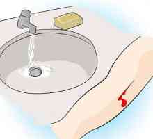 Рязане в ръцете: първа помощ. Какво да направите, когато рязате ръка с нож, острие или стъкло?