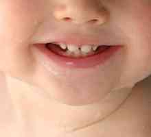 Редът и схемата на зъбите в детето