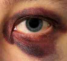 Повреди на очите: причини и методи на лечение. Видове наранявания на очите
