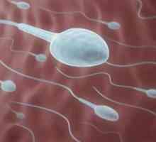 Повишен вискозитет на сперматозоидите: причини и лечение. Нормален вискозитет на сперматозоидите