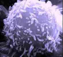 Повишени лимфоцити: кой е виновен и какво да правим?