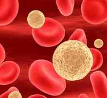 Повишени кръвни лимфоцити при деца: това, което трябва да знаете