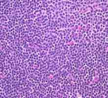 Повишени лимфоцити в кръвта на децата - опасно ли е?