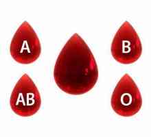 Правила за определяне на кръвната група според системата ABO