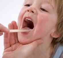 Правилно лечение на аденоидит при деца