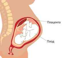 Преждевременно узряване на плацентата: причини, симптоми и признаци на лечение