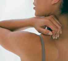 Причината за акне на гърба на жените. Методи на лечение