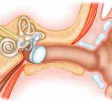 Корк в ухото: симптоми, начини на отстраняване