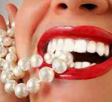 Професионално избелване на зъбите: методи, противопоказания