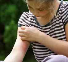 Предотвратяване и лечение на ухапвания от комари при деца