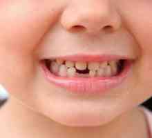 Дъщене и нарастване на зъбите при деца: маса. Всичко за изригването на бебешки зъби при бебета