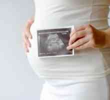 Псориазис и бременност: лечение, възможни последици