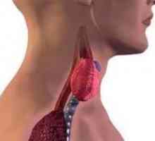 Радиоактивен йод: лечение на патологии на щитовидната жлеза