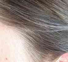 Ранна сива коса: причини и лечение при жени и мъже