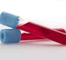 Декодиране на кръвния тест: характеристики, основни показатели и норма