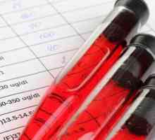 Декодиране на биохимичния кръвен тест при възрастни (таблица). Биохимичен кръвен тест при деца:…