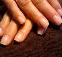 Структуриране на ноктите върху ръцете: причини и лечение