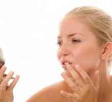 Дразнене и зачервяване около устата - възможни причини и характеристики на лечението